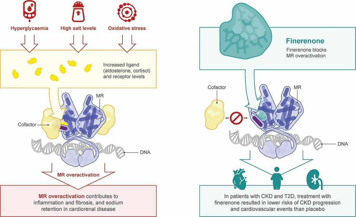 Fig. 1 Proposed mode of action and pharmacology of finerenone. (Lerma EV, Wilson D J. 2022)
